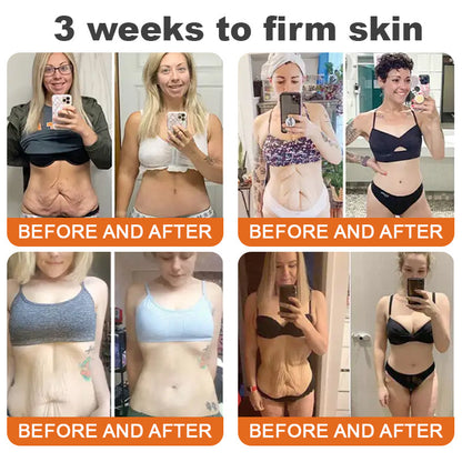 🐝💖Flysmus™ Botox Bee Venom Firming Serum Stick-(Made and Shipped from Australia)-LAST DAY 70% OFF