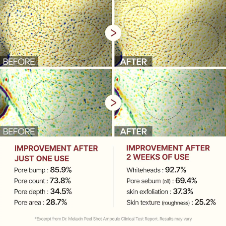 ⏰ Final 3 Hours! 60% OFF ✨ Gentle Rice Peel Duo for Dead Skin & Blackhead Control — Face & Body Care