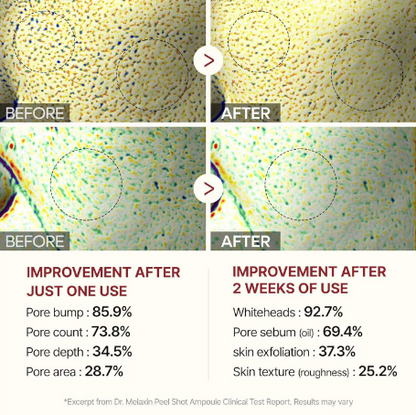 ⏰ Final 3 Hours! 60% OFF ✨ Gentle Rice Peel Duo for Dead Skin & Blackhead Control — Face & Body Care